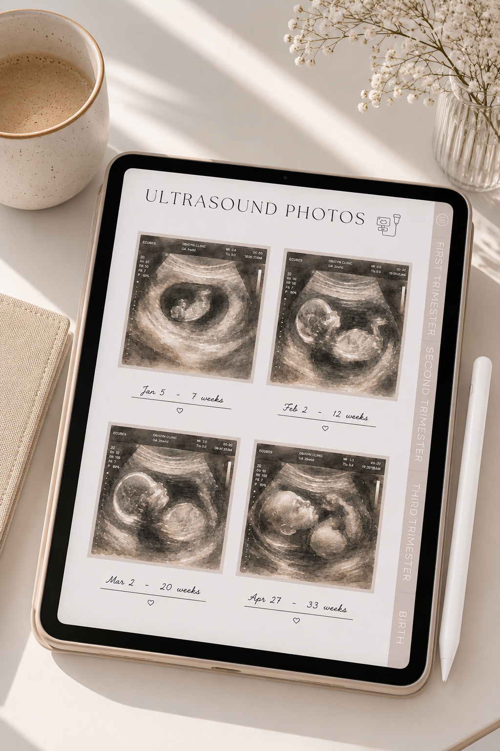 Why Every First-Time Mom Should Keep a Pregnancy Journal