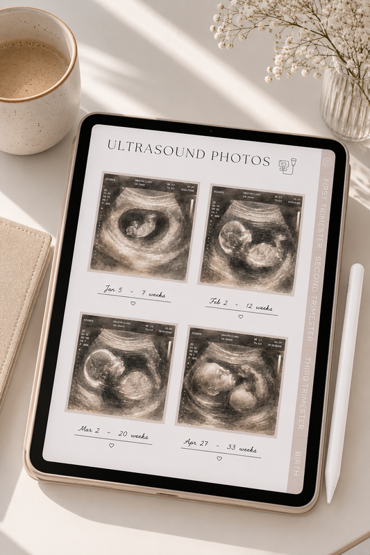 Why Every First-Time Mom Should Keep a Pregnancy Journal